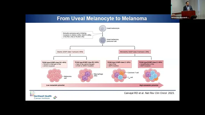 Preventing Recurrence in Uveal Melanoma: The Role of Adjuvant Therapies