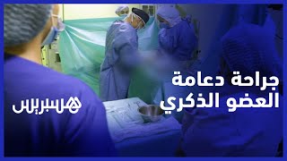 لعلاج الضعف الجنسي.. طاقم طبي مغربي يشرف على جراحة دعامة العضو الذكري الأولى في البلاد