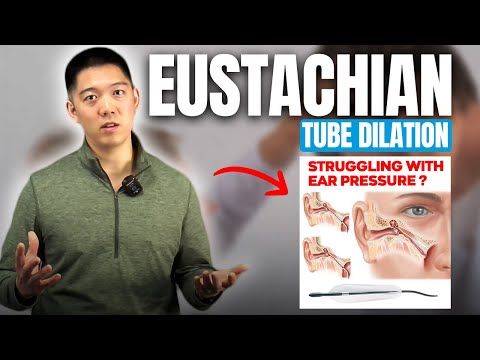 Eustachian Tube Balloon Dilation: How to Fix Ear Pressure & Fullness | ENT Doctor Explains