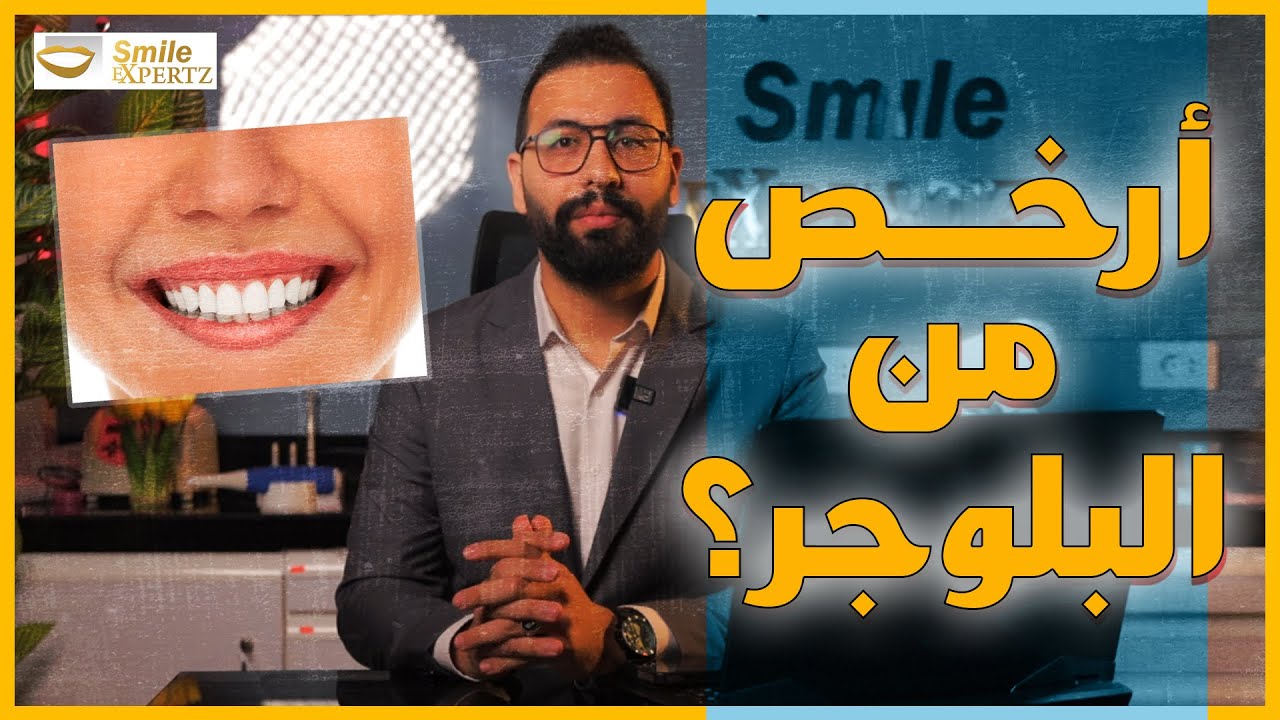 متستخسرش في الفنيرز علشان متندمش 🦷 ❌