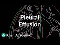 What is a pleural effusion? | Respiratory system diseases | NCLEX-RN | Khan Academy