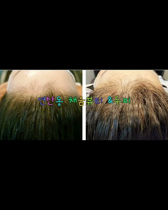 채움뷰티&두피 - YouTube 채움뷰티&두피