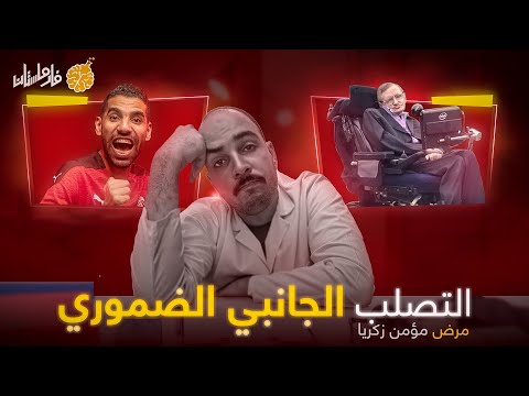 فارماستان التصلب الجانبي الضموري مؤمن زكريا