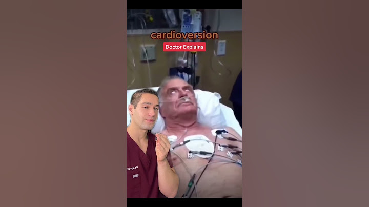 Reset for the heart aka Cardioversion - Doctor Explains #doctor #shorts