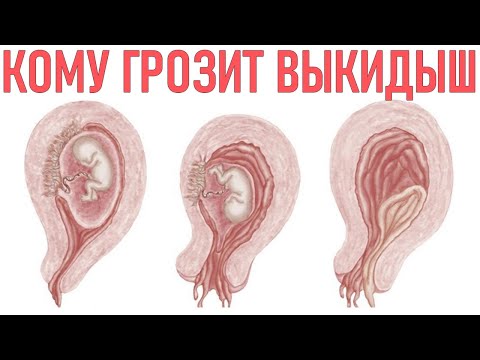 Видео: Что значит угрожающе?