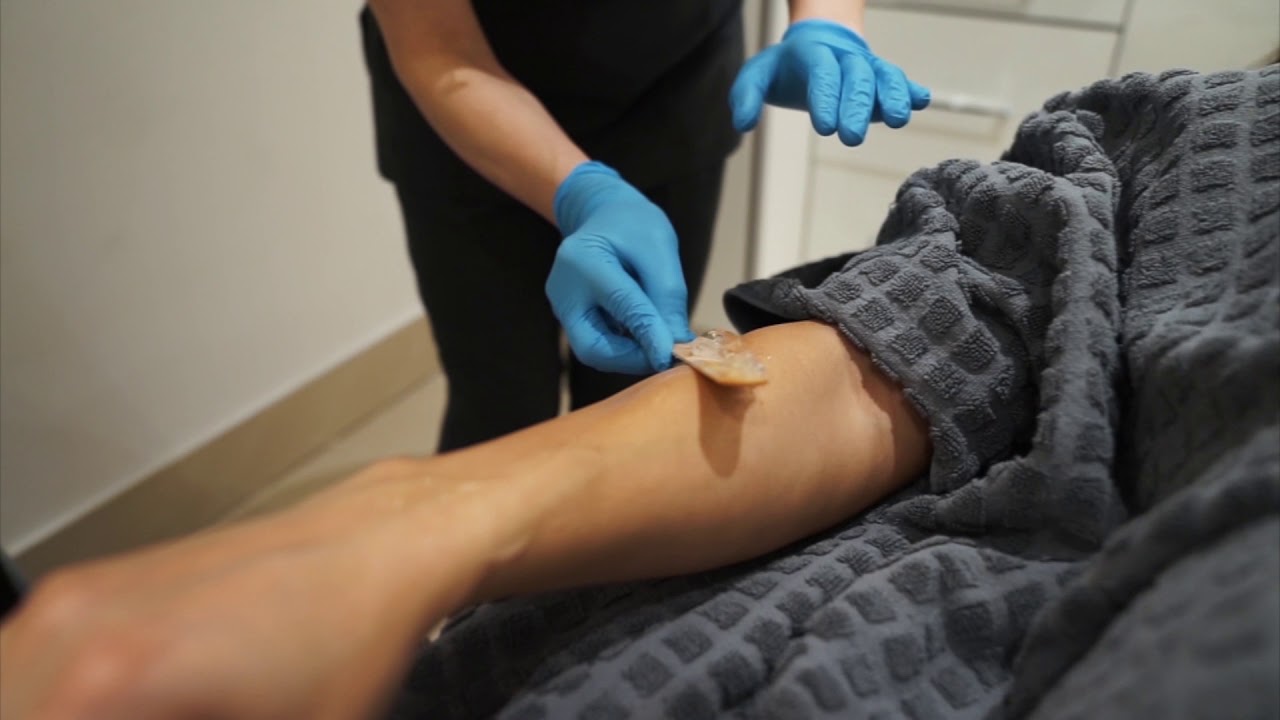 @itsalwayshana Laser AD - Hannah London