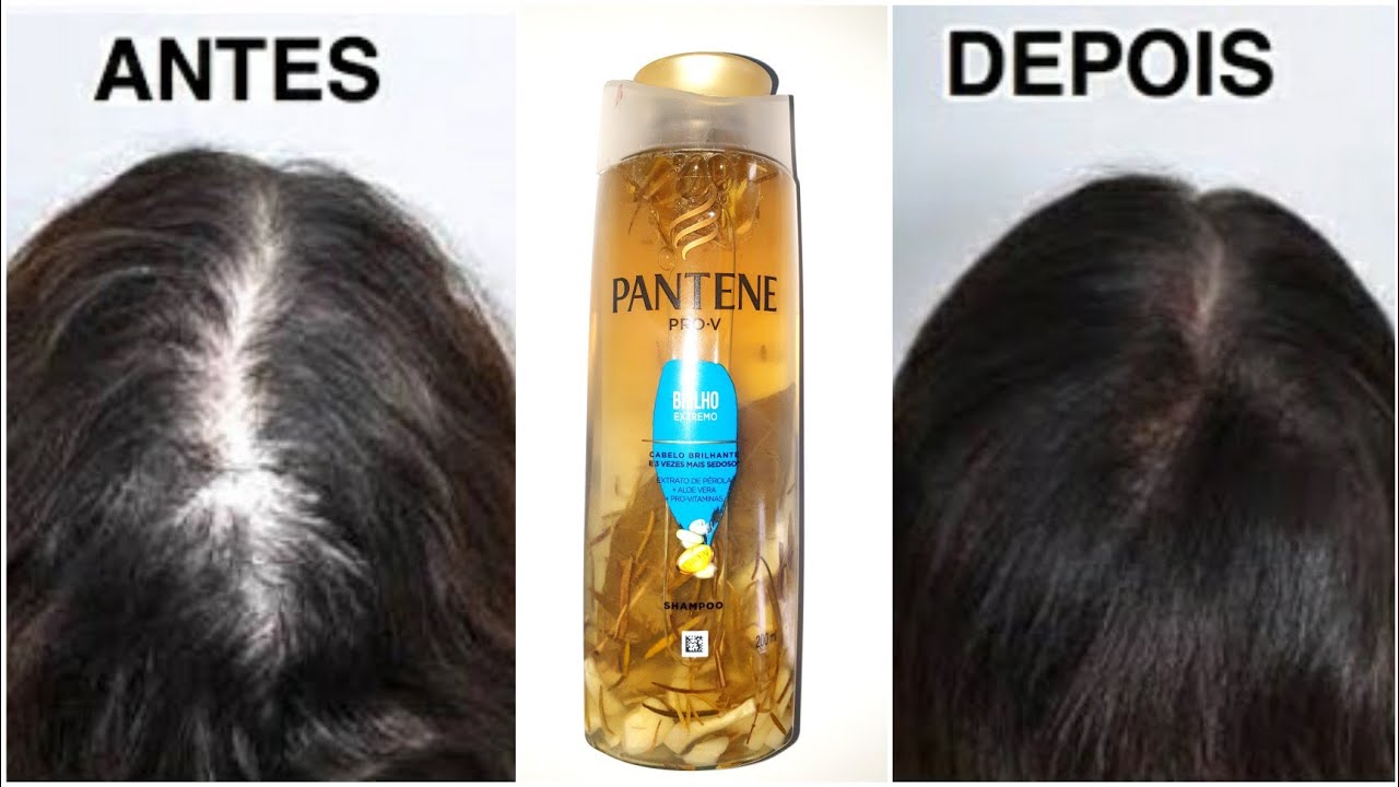 USEI QUANDO MEU CABELO ESTAVA CAINDO, CRESCE CABELO MUITO RÁPIDO | BRUNA LANNES