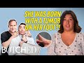 Destiny Was Born With a GROWTH On Her Foot?! (Before &amp; After) | Botched | E!