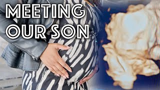 Meeting Our Son *4D Scan* @RegoDise