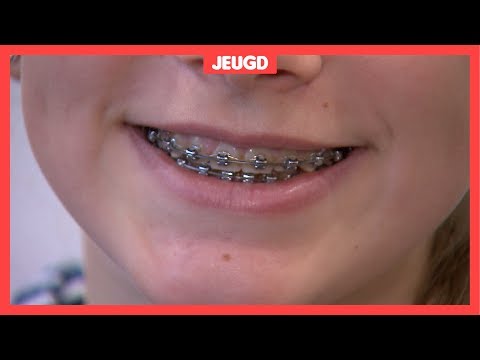 Video: 3 manieren om tanden los te maken