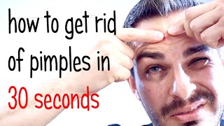 Get rid of pimples or acne in 30 seconds - Men