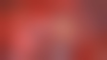 Uniportal VATS right anterior (RS3) segmentectomy