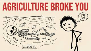 Your Teeth, Your Back, Your Height | All Ruined 12,000 Years Ago