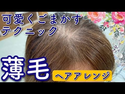 薄毛の方のヘアアレンジやスタイリングで薄毛を隠すコツ Youtube