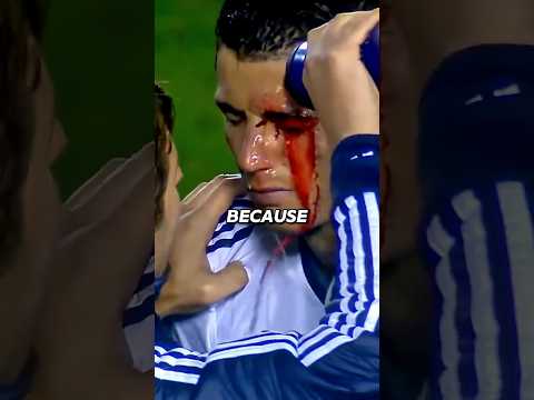 Ronaldo Almost Dead On The Pitch And Left Everyone Crying Ronaldo Cristianoronaldo Viral 