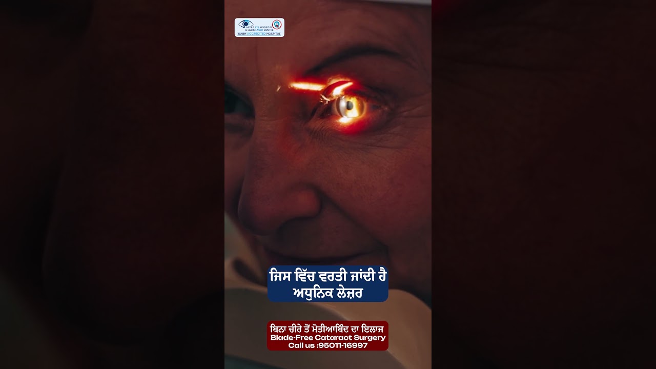 Cataract Surgery in Phagwara | Mitra Eye Hospital