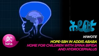 Hope SBH in Addis Ababa |Hiwote
