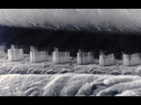 Now you hear it, now you don’t: the neuroscience of deafness - Now you hear it, now you don’t: the neuroscience of deafness