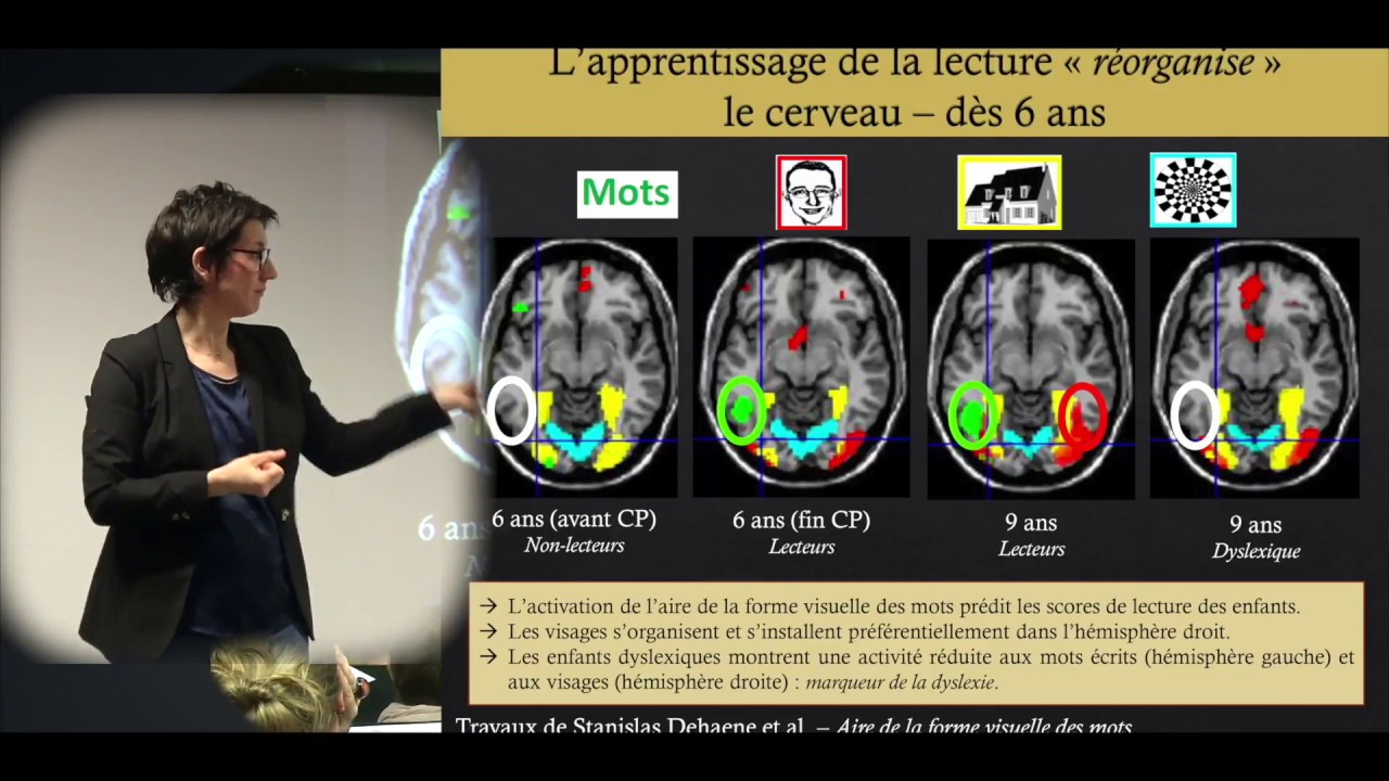 Conférence  - La dyslexie à l'université : comprendre pour mieux accompagner (2)