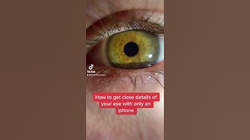 How To Get Close Up Details Of Your Eye With An iPhone