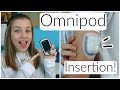HOW TO CHANGE AN OMNIPOD!! Omnipod Insertion In Arm + Step By Step! | Laina Elyse