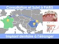 Implant dentaire à l etranger avec consultation et suivi a Paris
