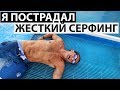 Я пострадал на серфинге. Ден вернулся! // Кейси Найстат