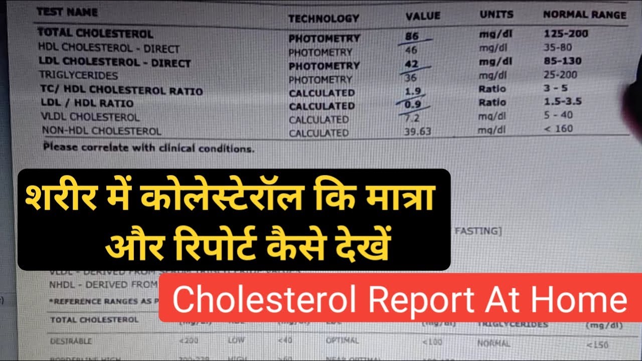 How To Read Cholesterol Report LDL HDL VLDL Test How To Read Cholesterol Report LDL HDL VLDL Test