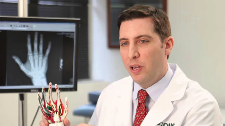 Carpal Tunnel Treatment l Mark Vitale, MD, hand surgeon