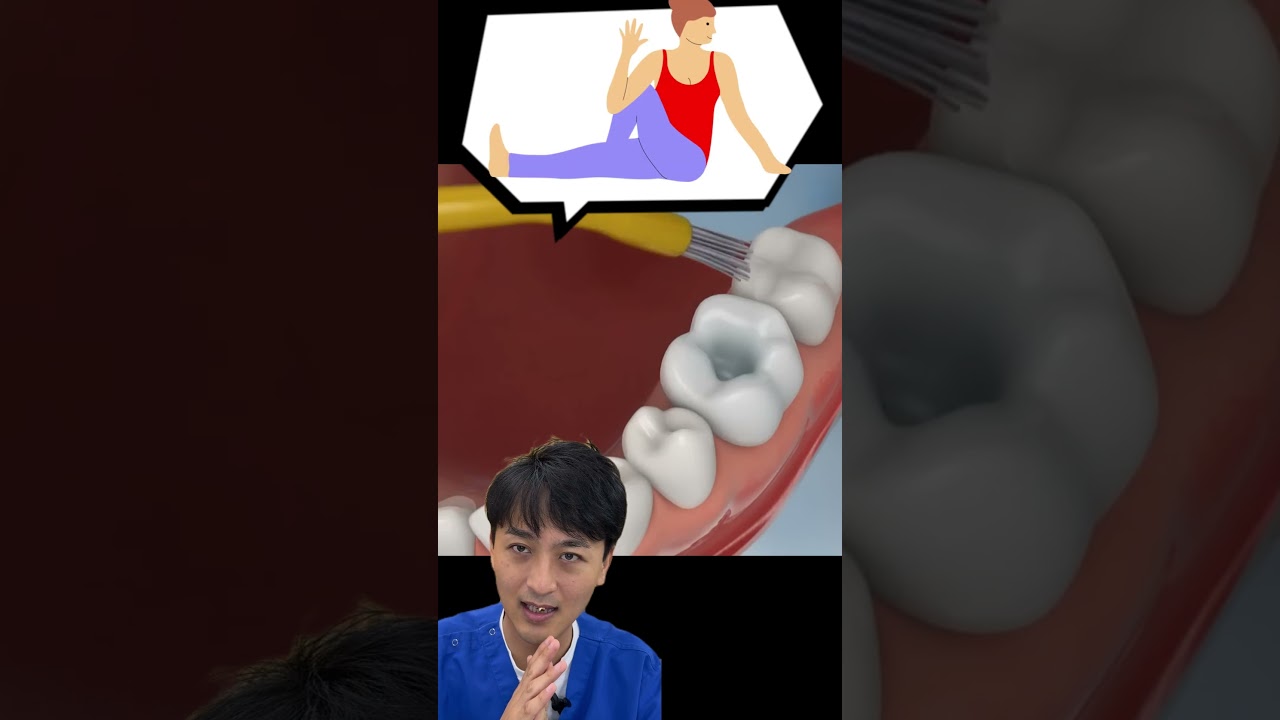 🦷奥歯🦷 #金歯先生 #歯医者 #dentist #歯科医師 #shorts #歯科矯正 #マウスピース矯正 #口臭 #ホワイトニング #歯石 #虫歯