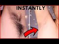 How I Removed My Armpit Hair Permanently Body Hair Removal