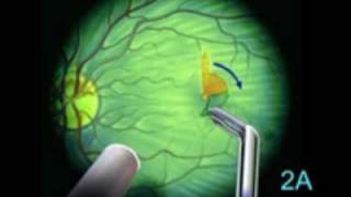 Routine Miracles with Dr. Conrad Fischer: Ophthamalology