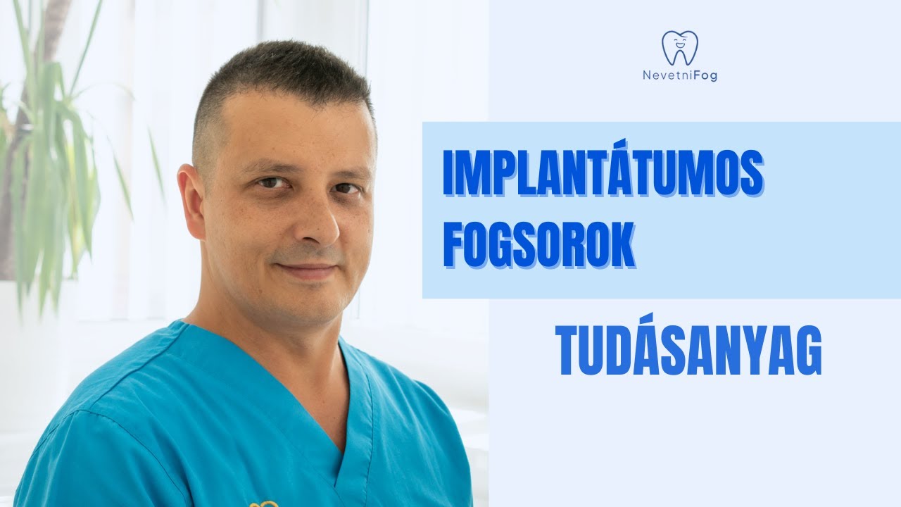 “Implantátumos Fogsorok” | Tudásanyag | NevetniFog - Dr. Kovács Roland
