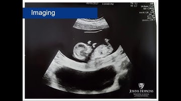 Applied Biomedical Engineering Information Session: Fall 2018