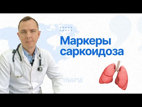 Про саркоидоз от врача-пульмонолога
