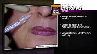 Aesthetic Plastic Surgery Video Atlas