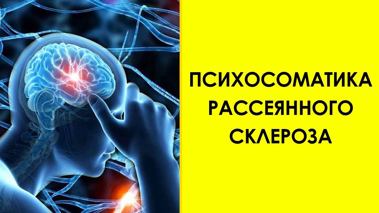 ПСИХОСОМАТИКА РАССЕЯННОГО СКЛЕРОЗА