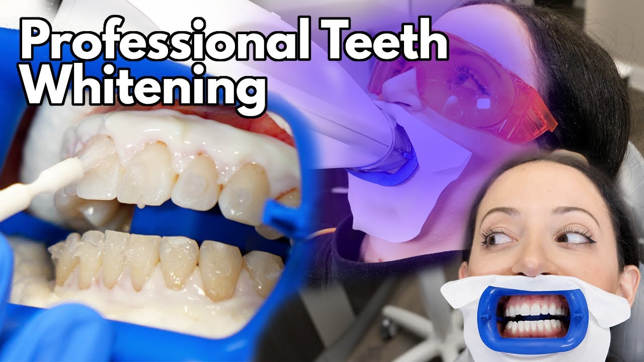 Teeth Whitening At The Dentist | Fastest Way To Whiten Your Teeth