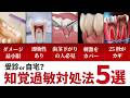 【保存版】いきなりキーン!となる知覚過敏への対処法5選