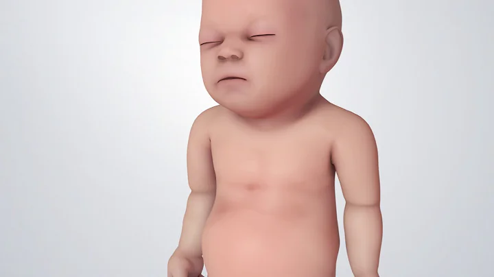 Warning Signs in Babies - DayDayNews