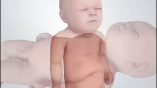 Tanda-tanda Peringatan pada Bayi