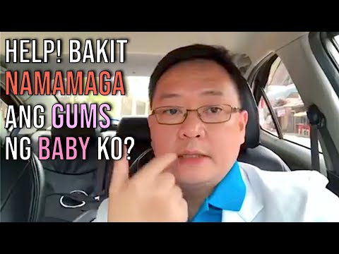 Video: Bakit May Red Gums Ang Bata
