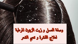 وصفة العسل و زيت الزيتون المرطبةلعلاج القشرة و تنعيم الشعر 