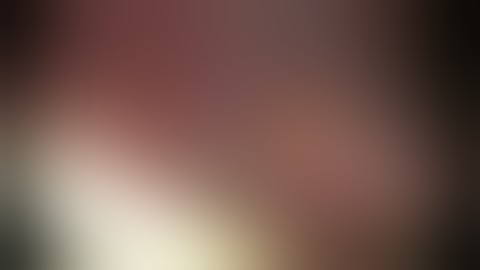 Laparoscopic esophageal salvage for perforations after surgical and endoscopic treatment of achalasi