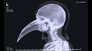 Real SCP - 049