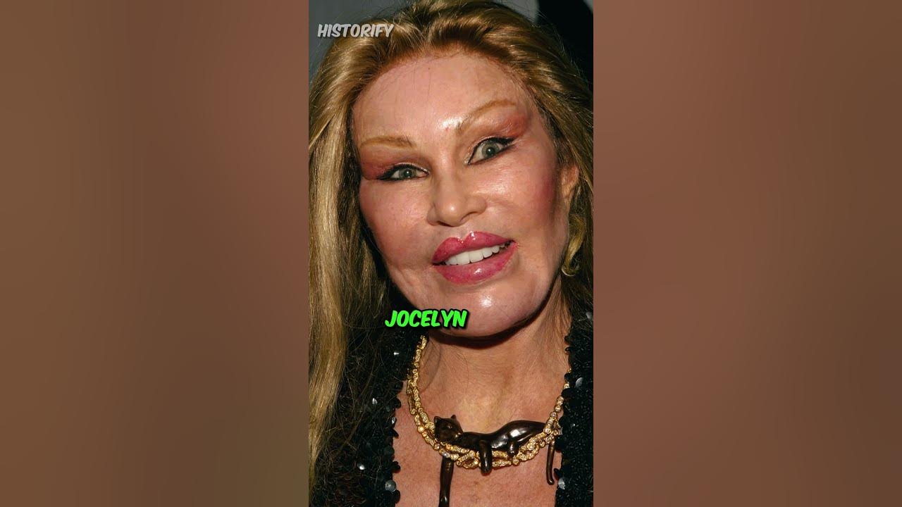 Now we get to play fashion police Celebrity plastic surgery, Bad celebrity plast