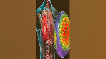 What is nipah virus #nipahvirus #sunshineglobalstar #health