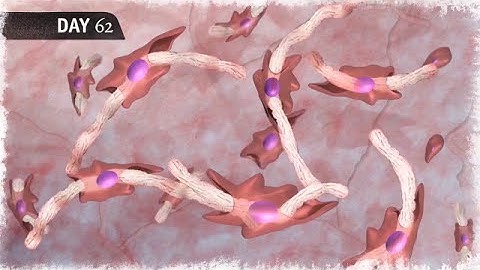 Geneveve by Viveve Mechanism of Action