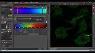 Leica SP8 triple stained BPAE Z stack