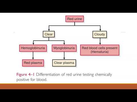 Urinalysis, Microalbuminuria, Ureum, Creatinin and Urine Protein